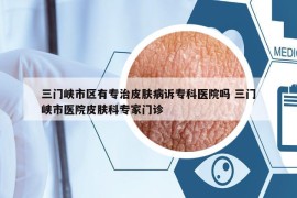 三門峽市區(qū)有專治皮膚病訴?？漆t(yī)院嗎 三門峽市醫(yī)院皮膚科專家門診