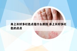 身上長好多紅色點(diǎn)是什么原因 身上長好多紅色的點(diǎn)點(diǎn)