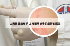 上海銀屑病知乎 上海銀屑病看的最好的醫(yī)生