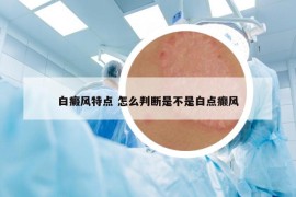白癜風(fēng)特點(diǎn) 怎么判斷是不是白點(diǎn)癲風(fēng)
