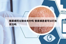 銀屑病可以做水光針嗎 銀屑病患者可以打水光針嗎