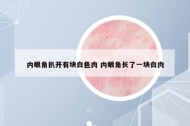 內(nèi)眼角扒開有塊白色肉 內(nèi)眼角長了一塊白肉