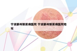 寧波鄞州銀屑病醫(yī)院 寧波鄞州銀屑病醫(yī)院地址