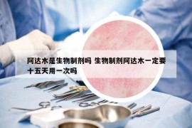 阿達(dá)木是生物制劑嗎 生物制劑阿達(dá)木一定要十五天用一次嗎