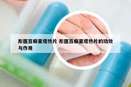 彤醫(yī)百癬夏塔熱片 彤醫(yī)百癬夏塔熱片的功效與作用