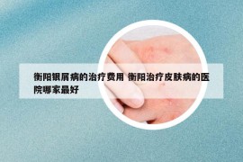 衡陽銀屑病的治療費用 衡陽治療皮膚病的醫(yī)院哪家最好