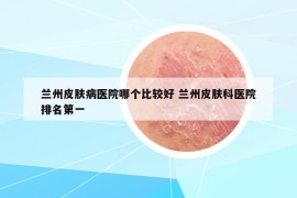 蘭州皮膚病醫(yī)院哪個(gè)比較好 蘭州皮膚科醫(yī)院排名第一