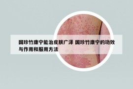 國珍竹康寧能治皮膚廣澤 國珍竹康寧的功效與作用和服用方法