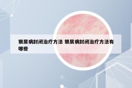 銀屑病封閉治療方法 銀屑病封閉治療方法有哪些