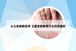 小兒皮膚癬咨詢 兒童皮膚癬用什么藥膏最好
