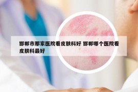 邯鄲市那家醫(yī)院看皮膚科好 邯鄲哪個(gè)醫(yī)院看皮膚科最好