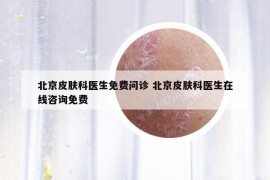 北京皮膚科醫(yī)生免費(fèi)問診 北京皮膚科醫(yī)生在線咨詢免費(fèi)