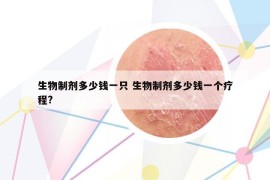 生物制劑多少錢一只 生物制劑多少錢一個療程?