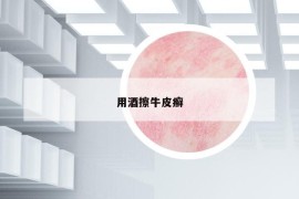 用酒擦牛皮癬