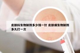 皮膚科生物制劑多少錢一針 皮膚病生物制劑多久打一次