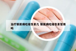 治療銀屑病吃維生素幾 銀屑病吃維生素管用嗎