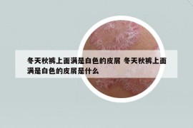 冬天秋褲上面滿是白色的皮屑 冬天秋褲上面滿是白色的皮屑是什么