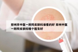 鄭州市中醫(yī)一附院皮膚科誰看的好 鄭州中醫(yī)一附院皮膚科哪個醫(yī)生好