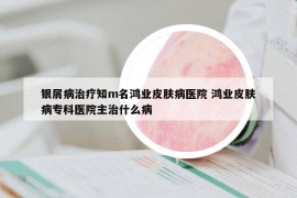 銀屑病治療知m名鴻業(yè)皮膚病醫(yī)院 鴻業(yè)皮膚病?？漆t(yī)院主治什么病