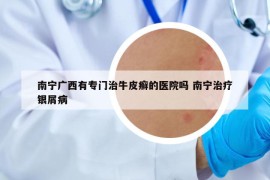 南寧廣西有專門(mén)治牛皮癬的醫(yī)院?jiǎn)?南寧治療銀屑病