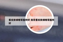 看皮膚病哪家醫(yī)院好 南京看皮膚病哪家醫(yī)院好