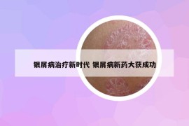 銀屑病治療新時(shí)代 銀屑病新藥大獲成功