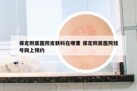 保定附屬醫(yī)院皮膚科在哪里 保定附屬醫(yī)院掛號網(wǎng)上預(yù)約