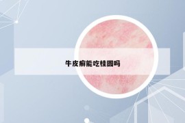 牛皮癬能吃桂圓嗎