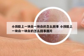 小孩臉上一塊白一塊白的怎么回事 小孩臉上一塊白一塊白的怎么回事圖片