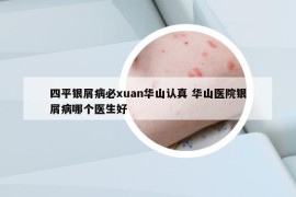 四平銀屑病必xuan華山認真 華山醫(yī)院銀屑病哪個醫(yī)生好