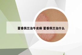 藿香佩蘭治牛皮癬 藿香佩蘭治什么