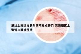 塘沽上海道皮膚科醫(yī)院幾點開門 濱海新區(qū)上海道皮膚病醫(yī)院