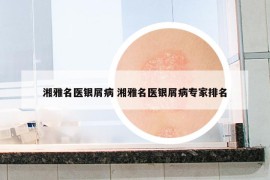 湘雅名醫(yī)銀屑病 湘雅名醫(yī)銀屑病專家排名