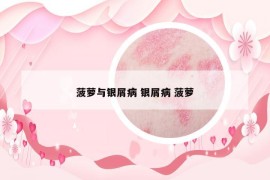 菠蘿與銀屑病 銀屑病 菠蘿