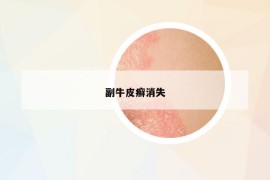 副牛皮癬消失