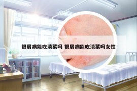銀屑病能吃淡菜嗎 銀屑病能吃淡菜嗎女性