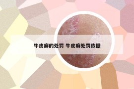 牛皮癬的處罰 牛皮癬處罰依據(jù)