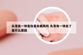 頭發(fā)有一塊變白是白癜風(fēng)嗎 頭發(fā)有一塊白了是什么原因