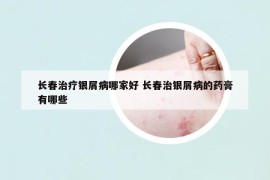 長(zhǎng)春治療銀屑病哪家好 長(zhǎng)春治銀屑病的藥膏有哪些