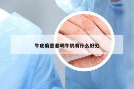 牛皮癬患者喝牛奶有什么好處