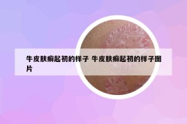 牛皮膚癬起初的樣子 牛皮膚癬起初的樣子圖片