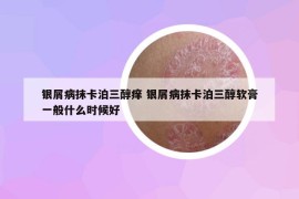 銀屑病抹卡泊三醇癢 銀屑病抹卡泊三醇軟膏一般什么時候好