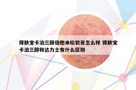 得膚寶卡泊三醇倍他米松軟膏怎么樣 得膚寶卡泊三醇和達力士有什么區(qū)別