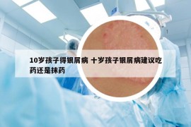 10歲孩子得銀屑病 十歲孩子銀屑病建議吃藥還是抹藥