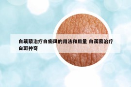 白蒺藜治療白癜風(fēng)的用法和用量 白蒺藜治療白斑神奇