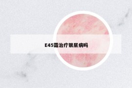 E45霜治療銀屑病嗎
