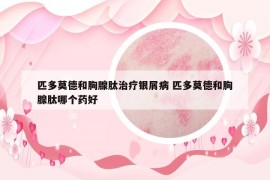 匹多莫德和胸腺肽治療銀屑病 匹多莫德和胸腺肽哪個(gè)藥好