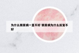 為什么銀屑病一直不好 銀屑病為什么反復不好