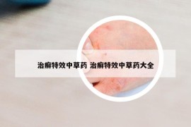 治癬特效中草藥 治癬特效中草藥大全