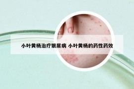 小葉黃楊治療銀屑病 小葉黃楊的藥性藥效
